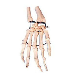 Palm Bone with Elbow-bone and Radial Bone Model 11125