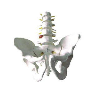 Pelvis with 5pcs Lumbar Vertebra Model 11129-3