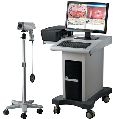Colposcope (Complete Set)