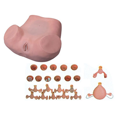 Gynecological Examination Model 7