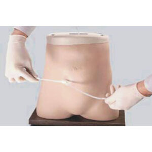 Peritoneal Dialysis Model F1